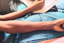 Photo of देखादेखी ब्लेड से हाथों को खरोंच लिया स्कूली बच्चों ने