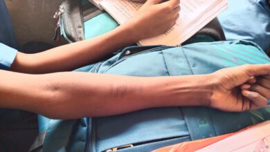 Photo of देखादेखी ब्लेड से हाथों को खरोंच लिया स्कूली बच्चों ने